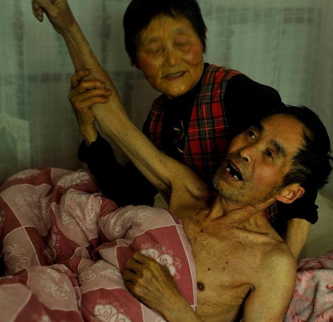 砒霜留下的癌症村