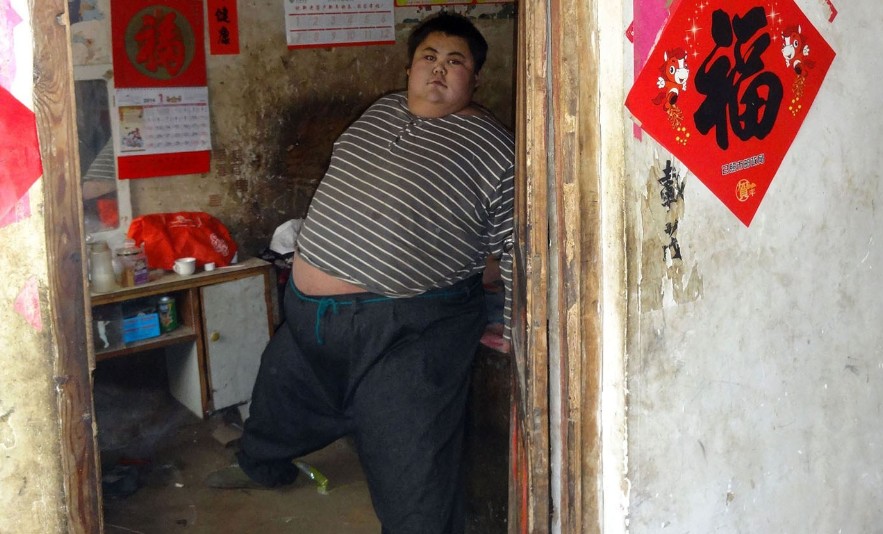 山东男子重600斤住院 10余人抬不动 